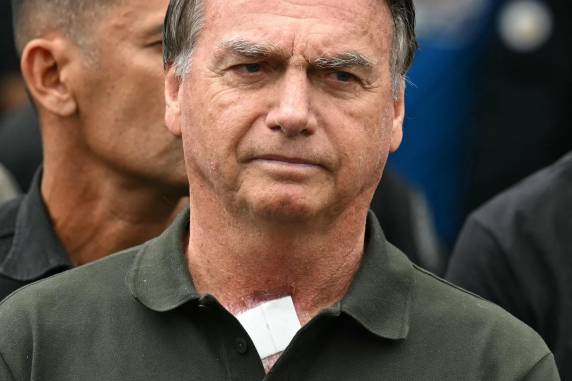 Defesa solicitou que ex-presidente vá para o hospital na véspera e realize o procedimento na quinta (25)